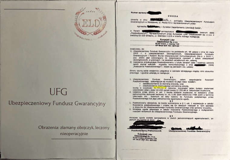 Dokument sprawy - Złamany obojczyk leczony nieoperacyjnie - UFG